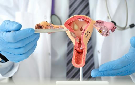 Gynecology Medical Tourism Kerala
